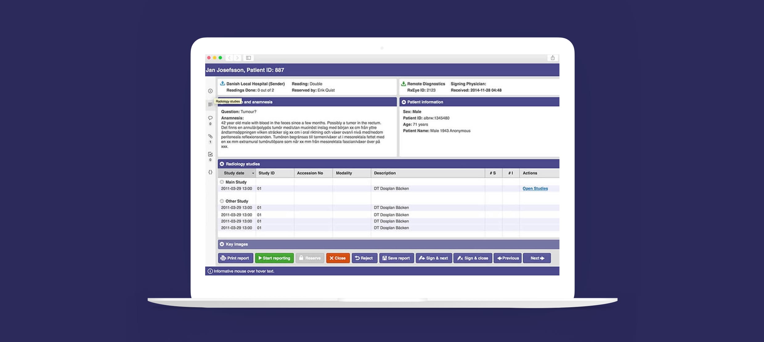 Radiology studies report interface on laptop showing patient information and study details