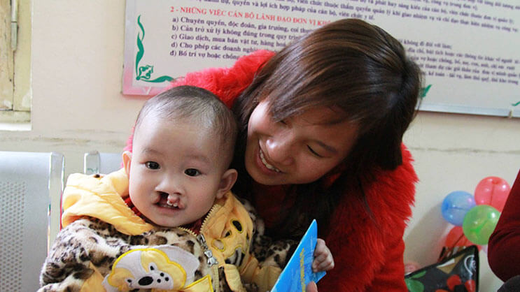 Child with cleft lip receiving supportive care from a smiling woman in clinical setting